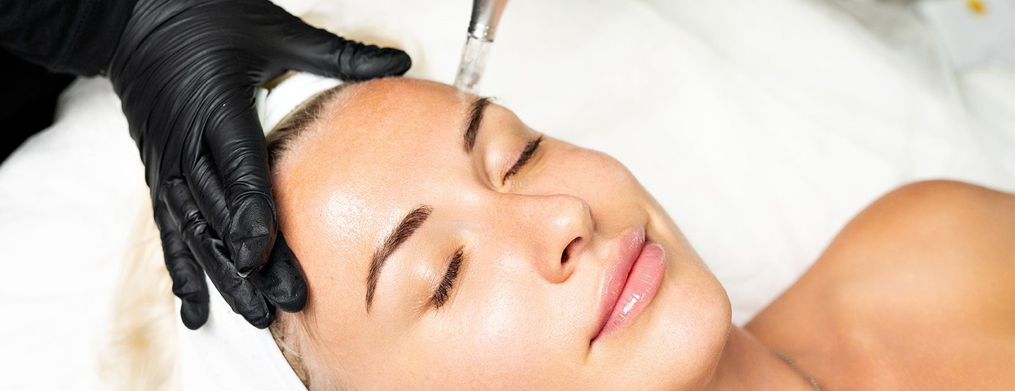 Microneedling: Das bringt der Anti-Aging-Trend laut Expertin wirklich  